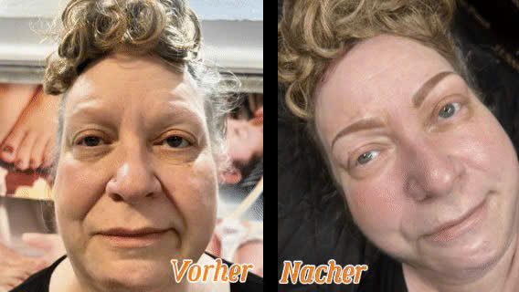Augenbrauenpigmentierung
